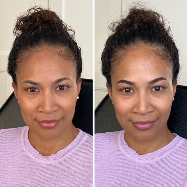 Before after image of the lady