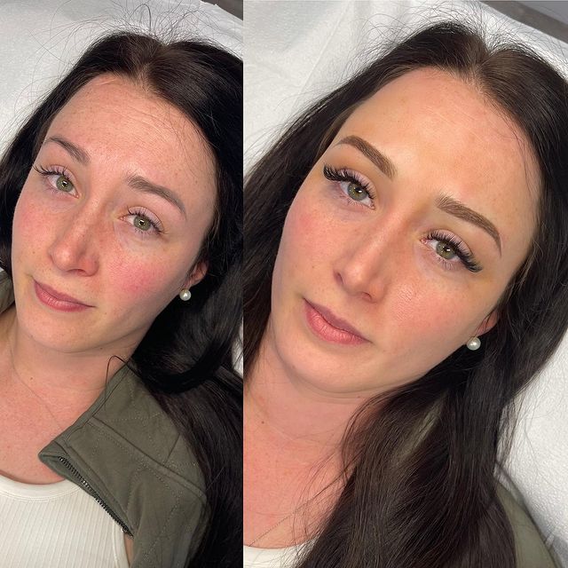 Lady face before and after image